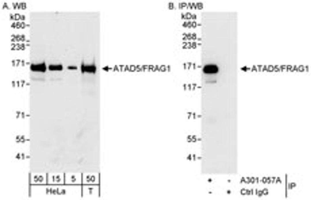 Detection of human ATAD5/FRAG1 by western blot and immunoprecipitation.