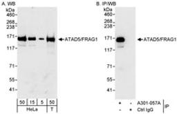 Detection of human ATAD5/FRAG1 by western blot and immunoprecipitation.