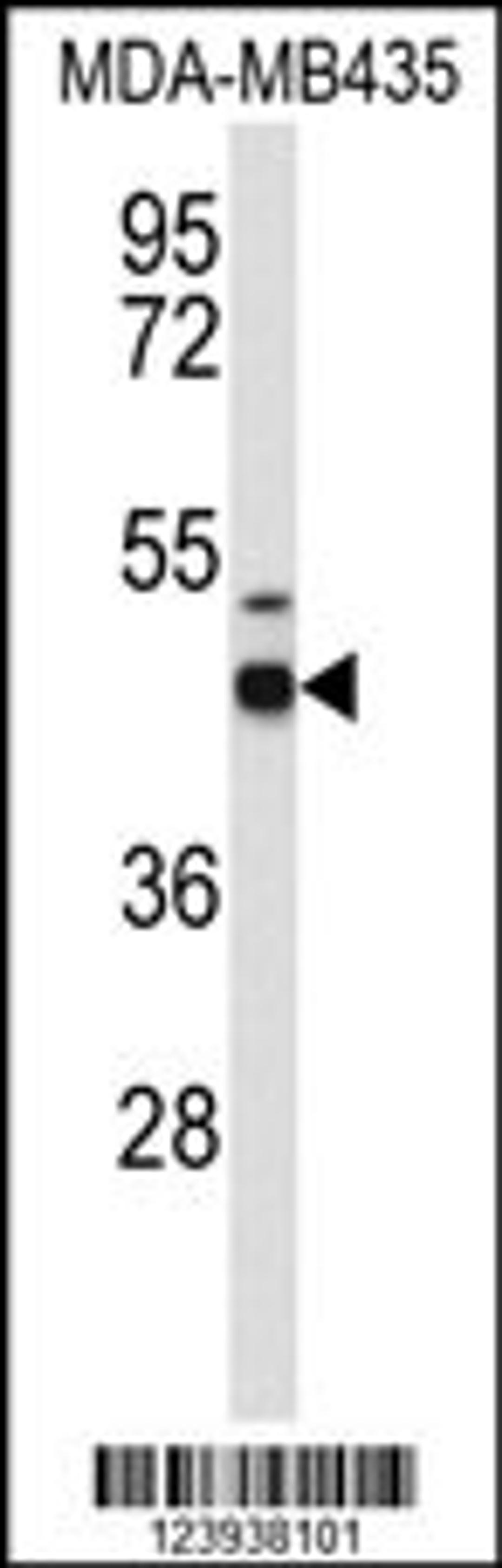 Western blot analysis of GABRD Antibody in MDA-MB435 cell line lysates (35ug/lane)