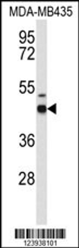 Western blot analysis of GABRD Antibody in MDA-MB435 cell line lysates (35ug/lane)