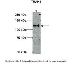 Western Blot: OIP106 Antibody [NBP1-56761] - Lanes: Lane1 : 10 ug myc-hTRAK1 transfected HEK293 lysate Primary Antibody Dilution: 1 : 500 Secondary Antibody: Anti-rabbit HRP Secondary Antibody Dilution: 1 : 2000 Gene name: TRAK1 Submitted by: Gulcin Pekkurnaz, F. M. Kirby Neurobiology Center.