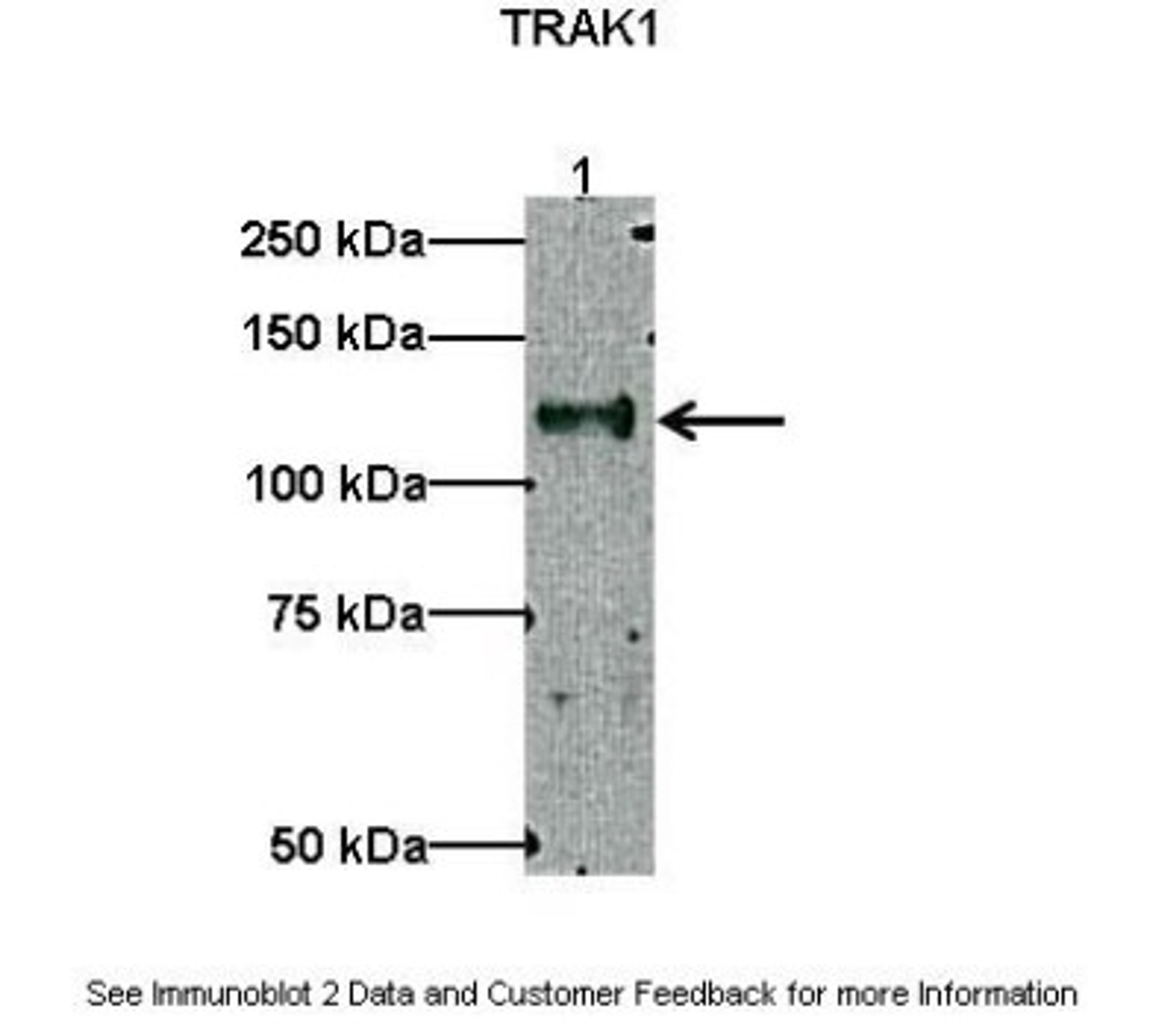 Western Blot: OIP106 Antibody [NBP1-56761] - Lanes: Lane1 : 10 ug myc-hTRAK1 transfected HEK293 lysate Primary Antibody Dilution: 1 : 500 Secondary Antibody: Anti-rabbit HRP Secondary Antibody Dilution: 1 : 2000 Gene name: TRAK1 Submitted by: Gulcin Pekkurnaz, F. M. Kirby Neurobiology Center.