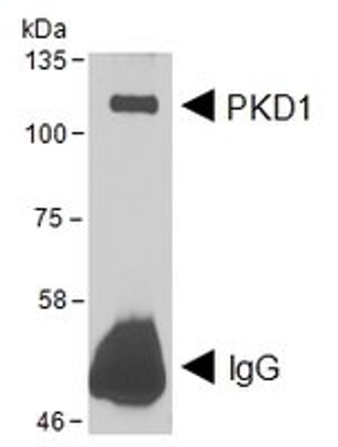 Western blot analysis of Human DYKDDDDK-tagged using PRKD1 antibody.