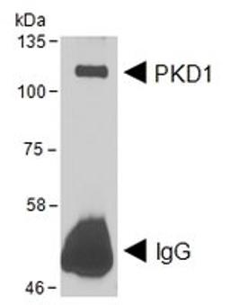 Western blot analysis of Human DYKDDDDK-tagged using PRKD1 antibody.