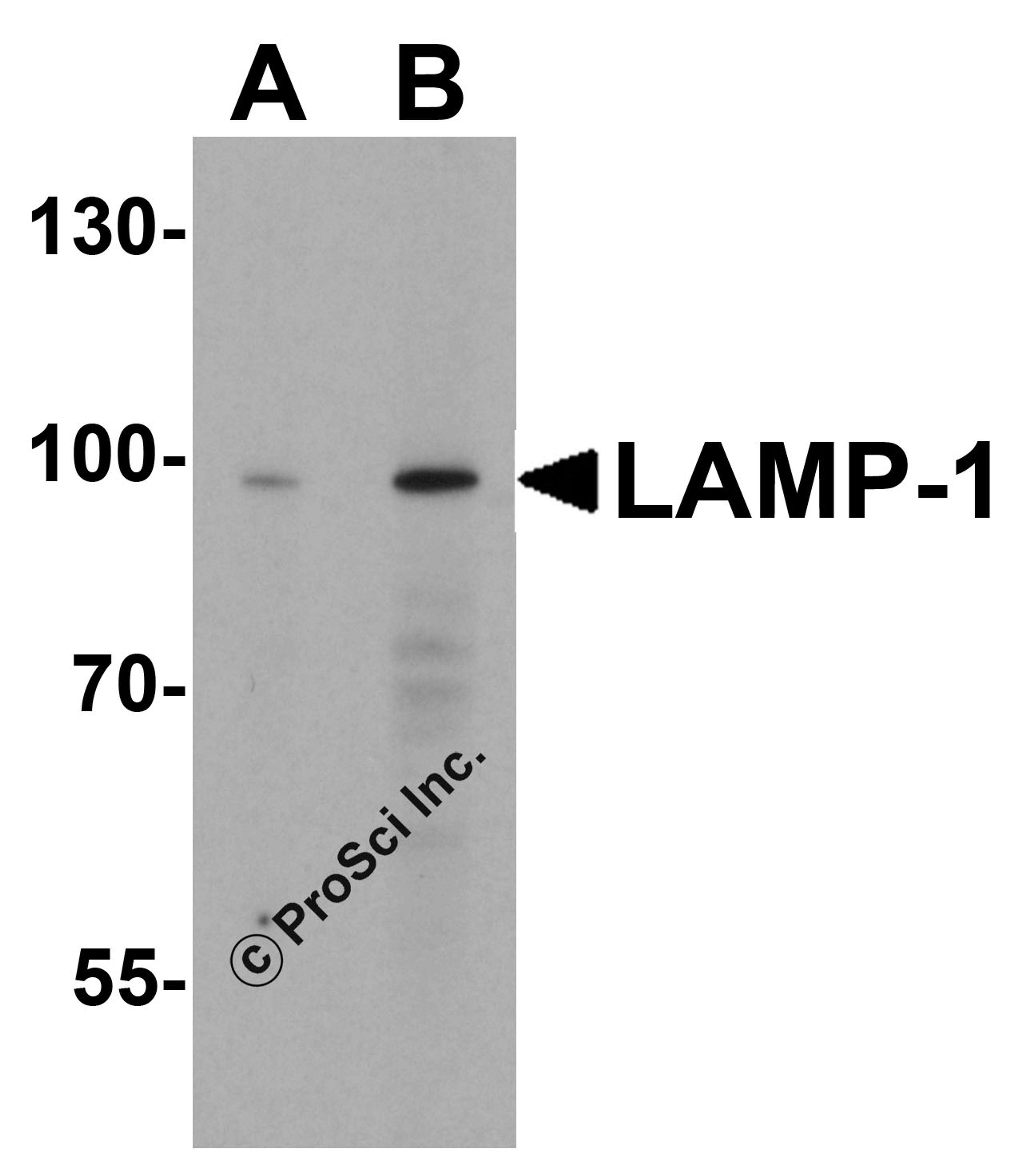 Western blot analysis of LAMP-1 in EL4 cell lysate with LAMP-1 antibody at (A) 1 and (B) 2 &#956;g/mL.