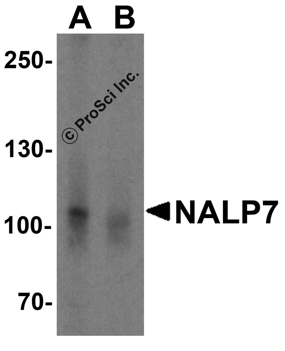 Western blot analysis of NALP7 in K562 cell lysate with NALP7 antibody at 2 μg/mL in (A) the absence and (B) the presence of blocking peptide.