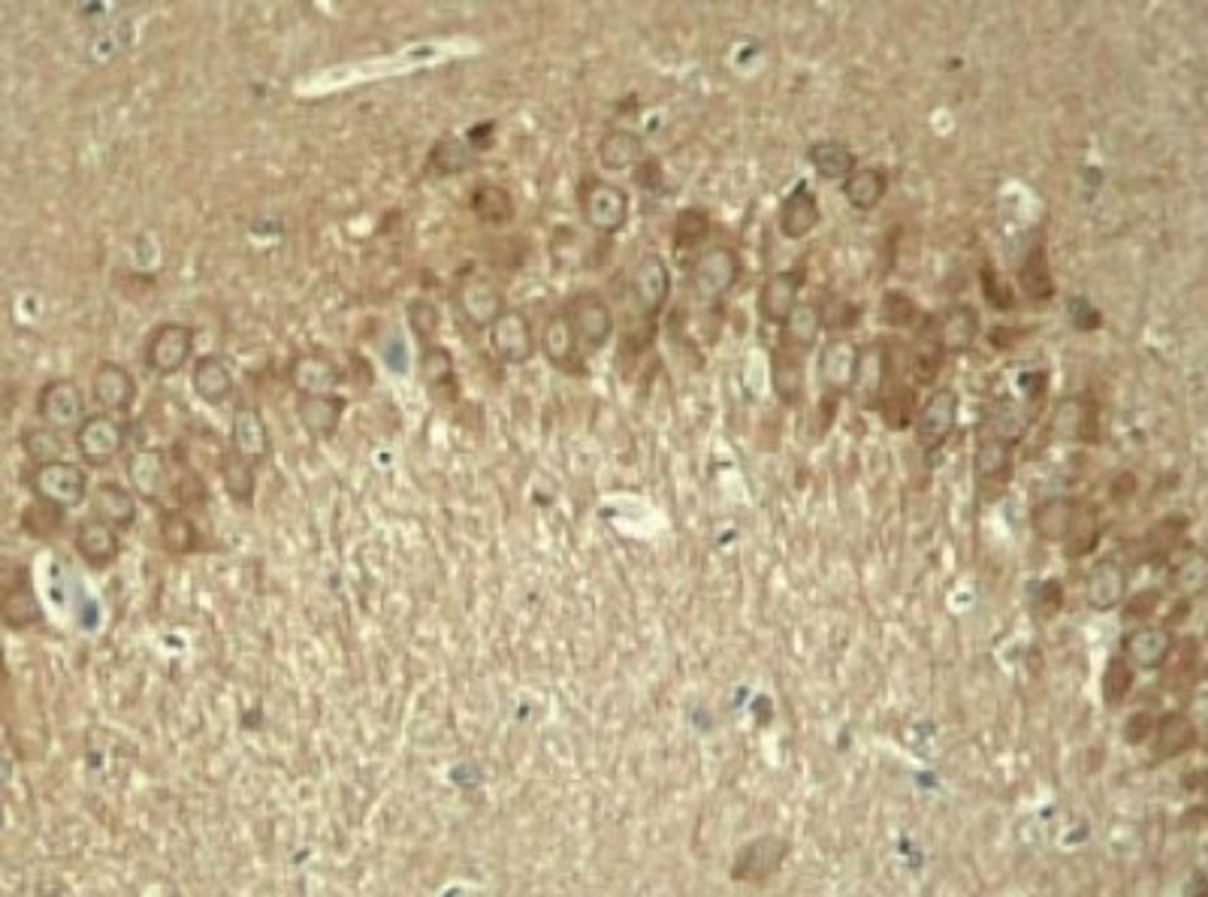 Immunohistochemistry: Tau [p Thr181] Antibody [NB100-82245] - Immunohistochemical analysis of paraffin-embedded rat hippocampal region tissue from a model with Alzheimer's Disease using Tau (phospho-Thr181) antibody.