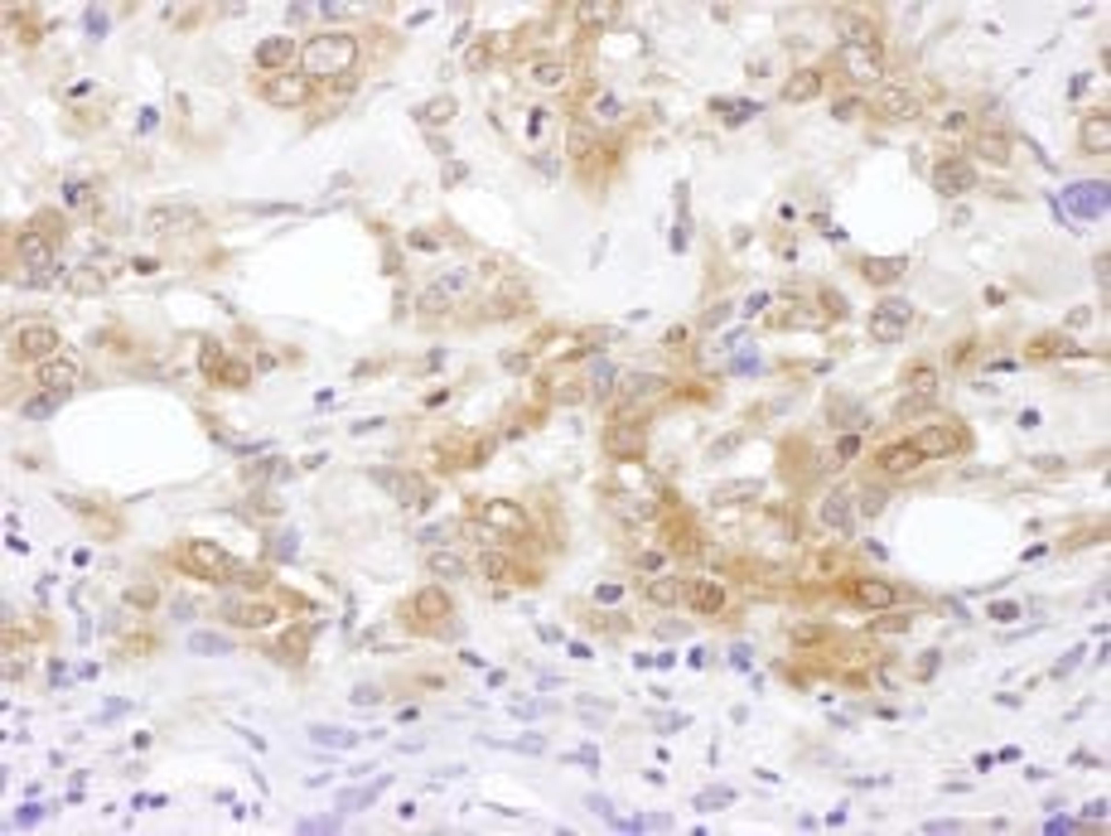 Detection of human MKK7 by immunohistochemistry.