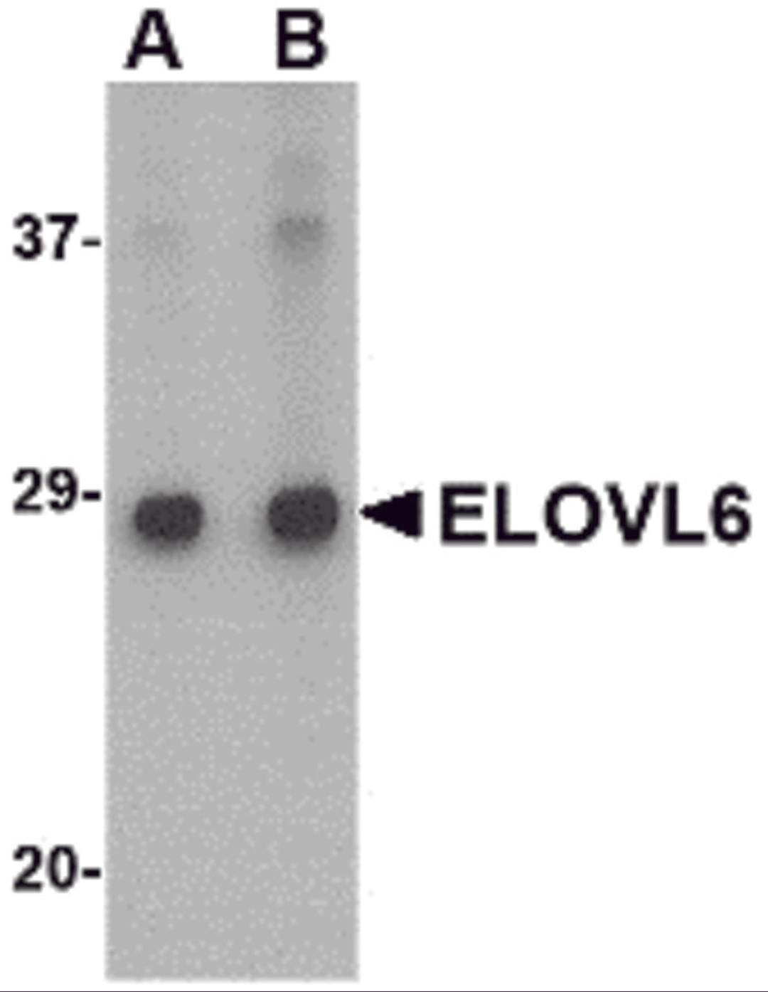 Western blot analysis of ELOVL6 in Human brain tissue lysate with ELOVL6 antibody at (A) 1 and (B) 2 &#956;g/mL.