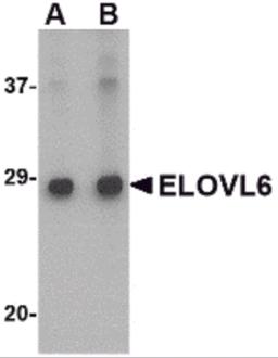 Western blot analysis of ELOVL6 in Human brain tissue lysate with ELOVL6 antibody at (A) 1 and (B) 2 &#956;g/mL.