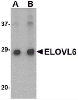 Western blot analysis of ELOVL6 in Human brain tissue lysate with ELOVL6 antibody at (A) 1 and (B) 2 μg/mL.