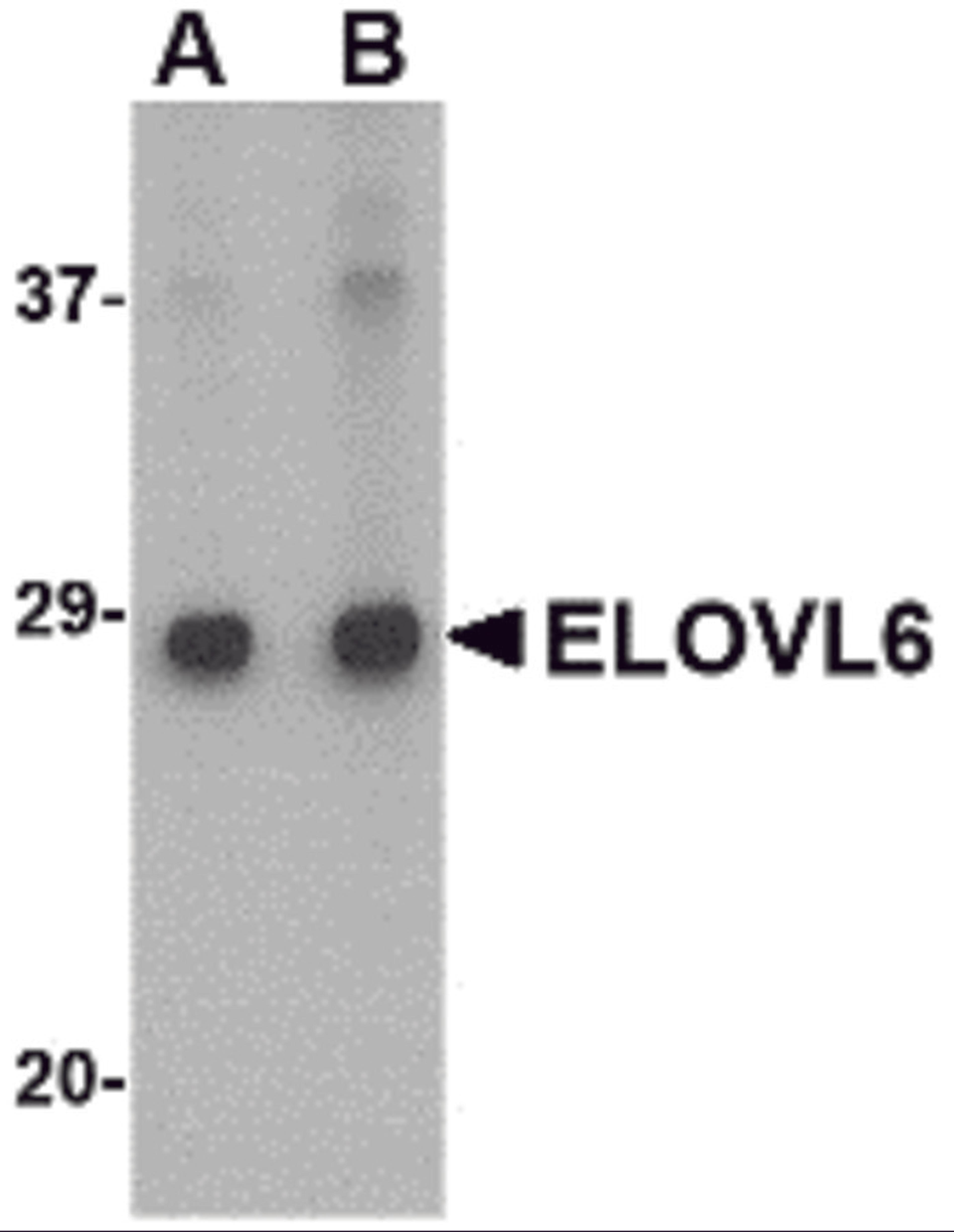 Western blot analysis of ELOVL6 in Human brain tissue lysate with ELOVL6 antibody at (A) 1 and (B) 2 μg/mL.