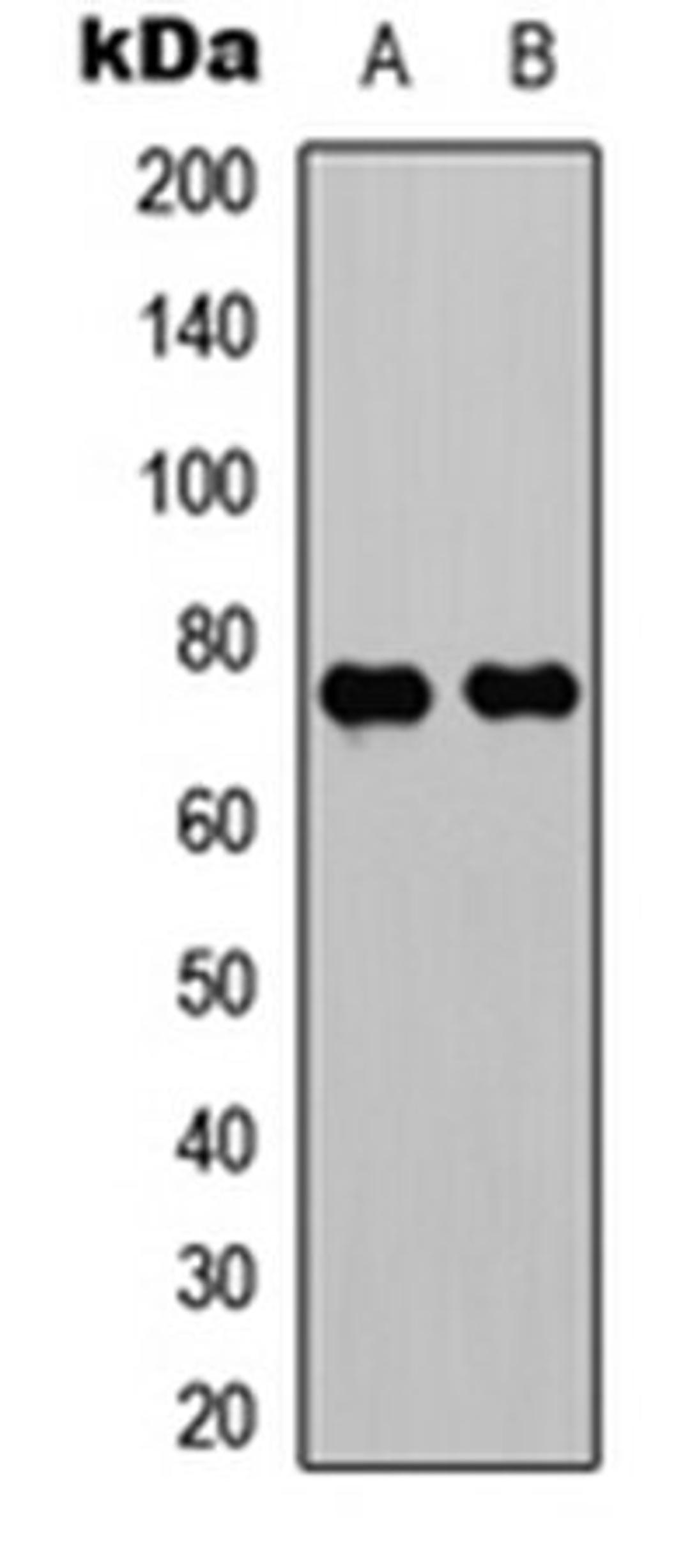 Western blot analysis of HeLa (Lane 1), K562 (Lane 2) whole cell lysates using WASF1 antibody