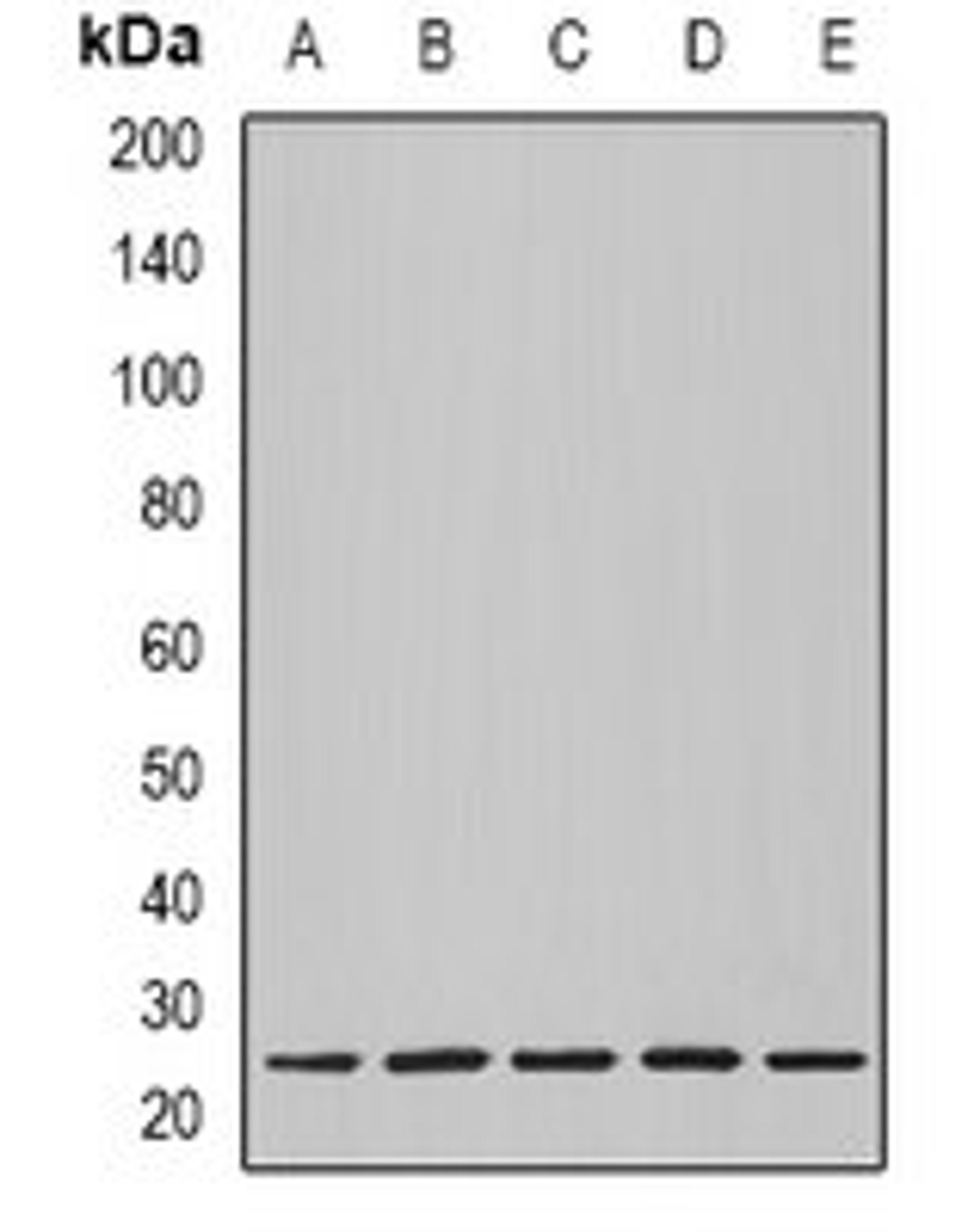 Western blot analysis of BT474 (Lane1), MCF7 (Lane2), mouse heart (Lane3), mouse lung (Lane4), rat heart (Lane5) whole cell lysates using NOL3 antibody