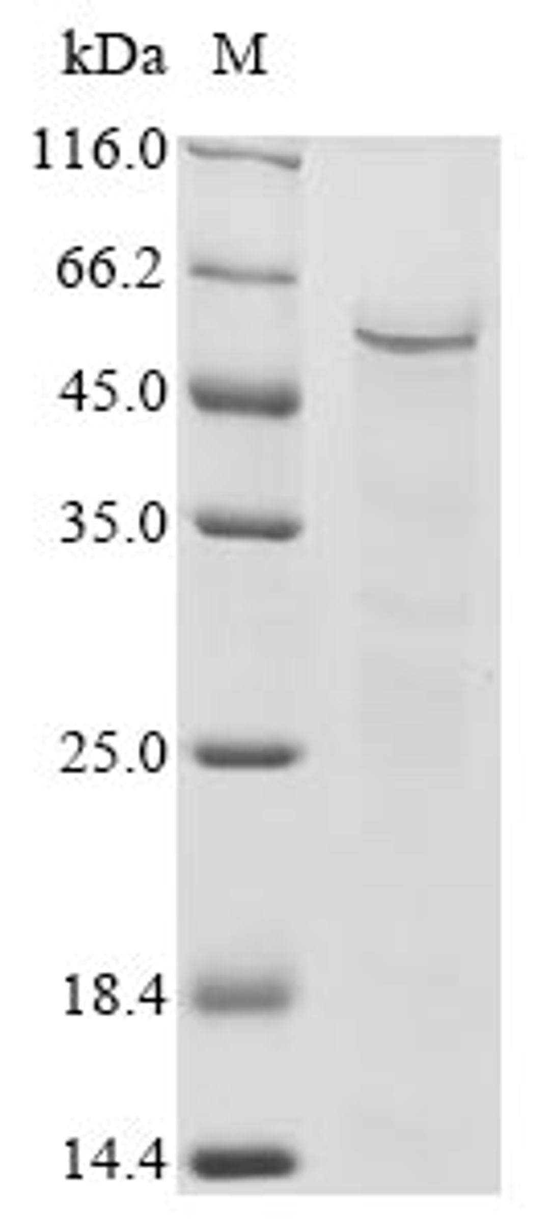 (Tris-Glycine gel) Discontinuous SDS-PAGE (reduced) with 5% enrichment gel and 15% separation gel.