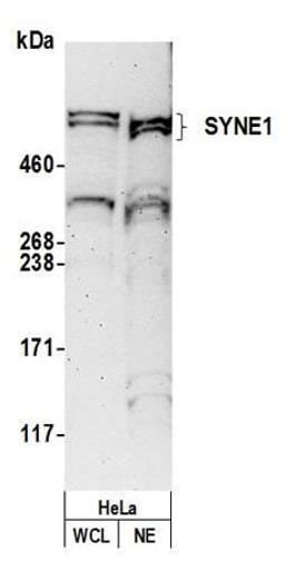 Detection of human SYNE1 by western blot.