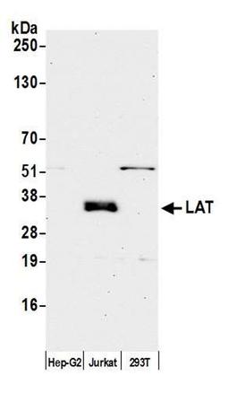 Detection of human LAT by WB.