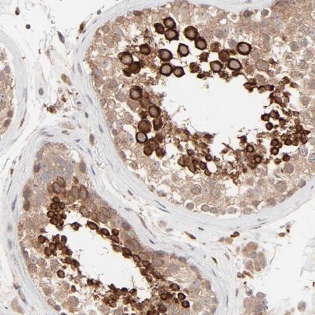 Immunohistochemistry-Paraffin: RAB5C Antibody [NBP1-80858] - Staining of human testis shows strong cytoplasmic positivity in cells in seminiferus ducts.