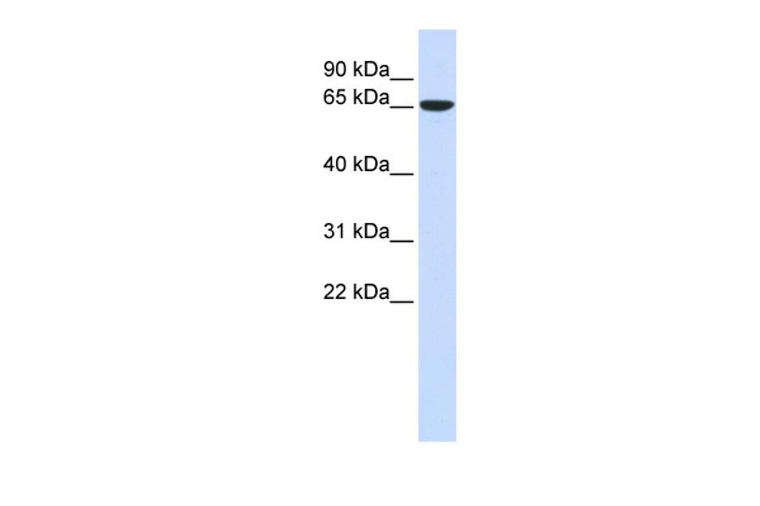 Antibody used in WB on Human 293T at 0.2-1 ug/ml.