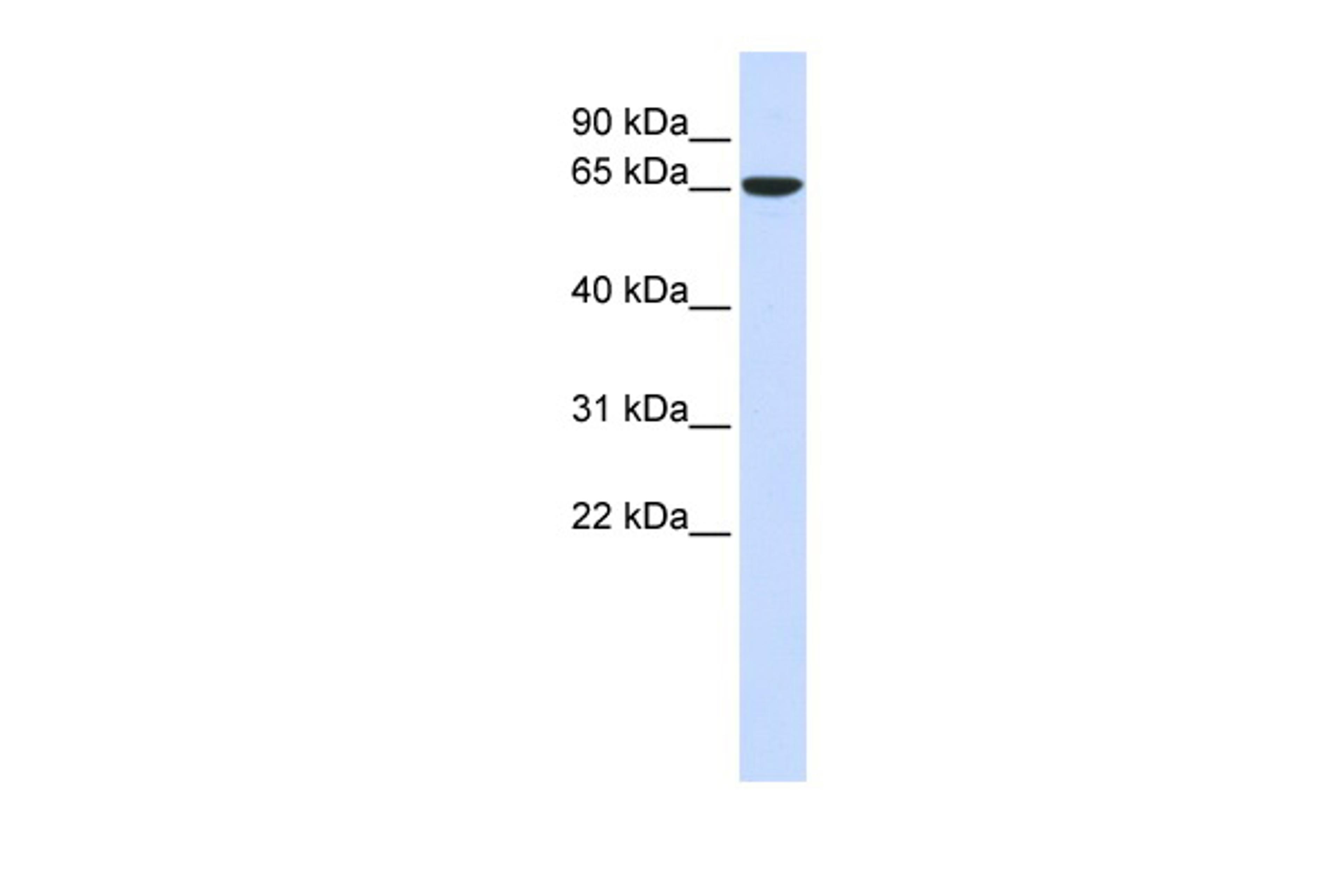 Antibody used in WB on Human 293T at 0.2-1 ug/ml.