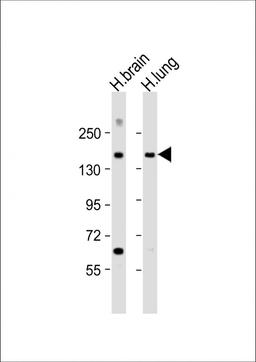 Western Blot at 1:2000 dilution Lane 1: human brain lysate Lane 2: human lung lysate Lysates/proteins at 20 ug per lane.