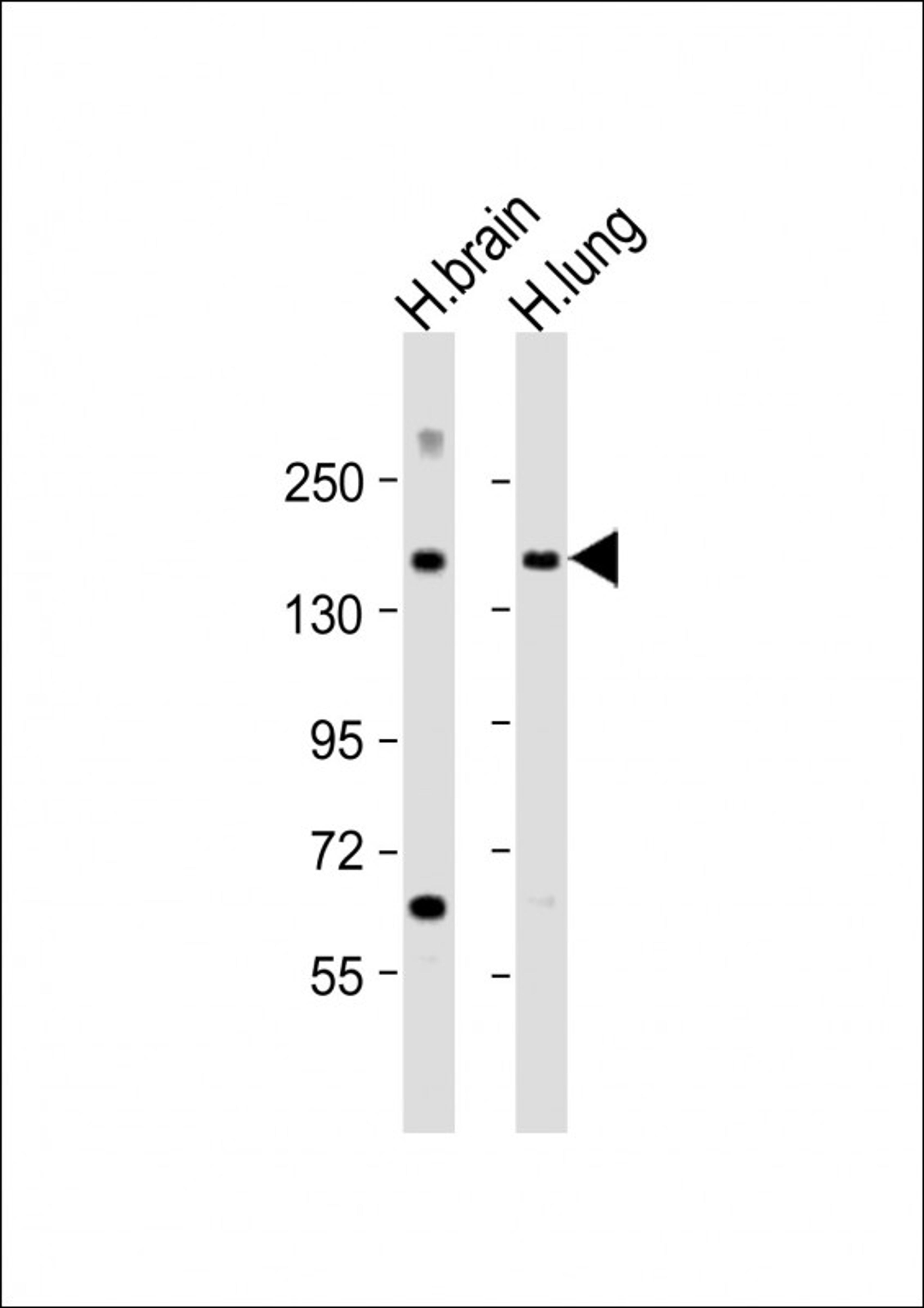 Western Blot at 1:2000 dilution Lane 1: human brain lysate Lane 2: human lung lysate Lysates/proteins at 20 ug per lane.