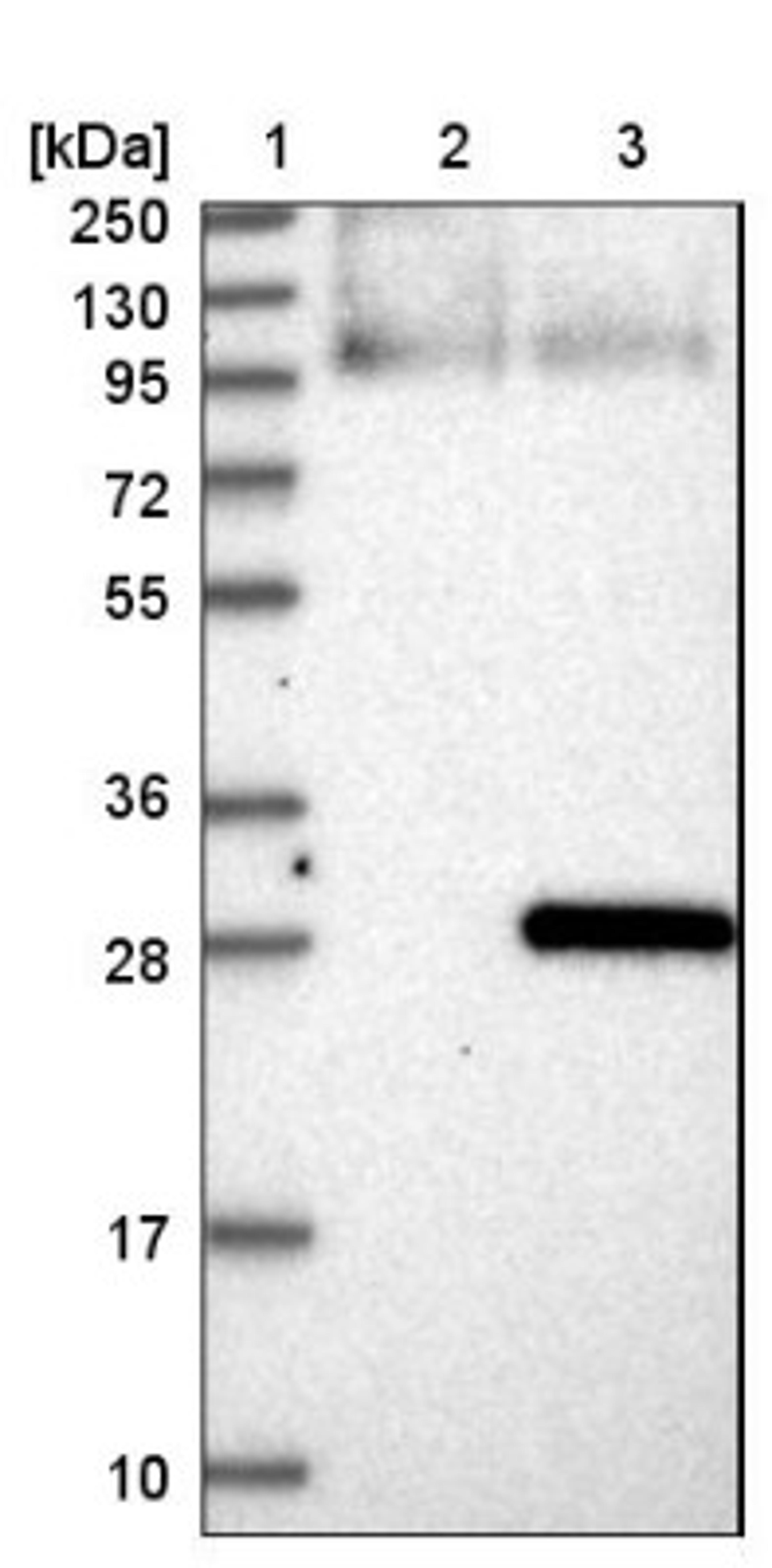 Western Blot: SP17 Antibody [NBP1-85409] - Lane 1: Marker [kDa] 250, 130, 95, 72, 55, 36, 28, 17, 10<br/>Lane 2: Negative control (vector only transfected HEK293T lysate)<br/>Lane 3: Over-expression lysate (Co-expressed with a C-terminal myc-DDK tag (~3.1 kDa) in mammalian HEK293T cells, LY413783)