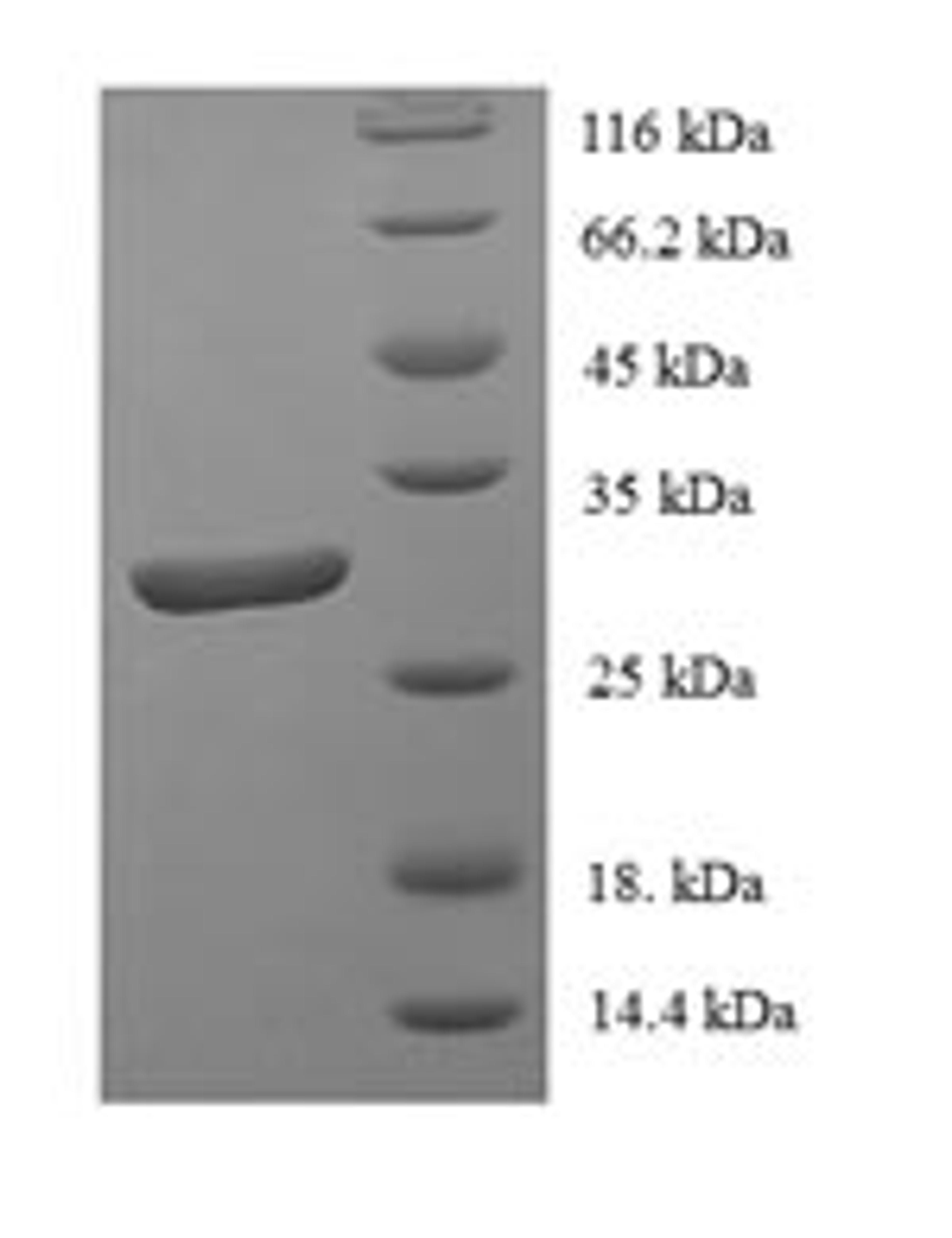 (Tris-Glycine gel) Discontinuous SDS-PAGE (reduced) with 5% enrichment gel and 15% separation gel.