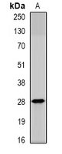 Western blot analysis of MCF7 (Lane1) whole cell lysates using SPINT2 antibody