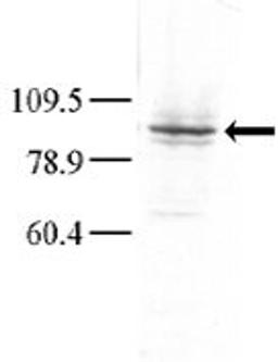 Western blot analysis of anti-GLK Pab in Hela cell lysate. Dilution for anti-GLK was 1:100; dilution for secondary goat anti-rabbit-HRP was 1:7000. A chemiluminescent kit was used for development of the Western blot. Data and protocol courtesy of Dr. Rich