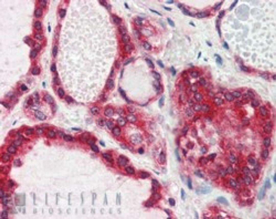 45-837 (2.5ug/ml) staining of paraffin embedded Human Thyroid Gland. Steamed antigen retrieval with citrate buffer pH 6, AP-staining.