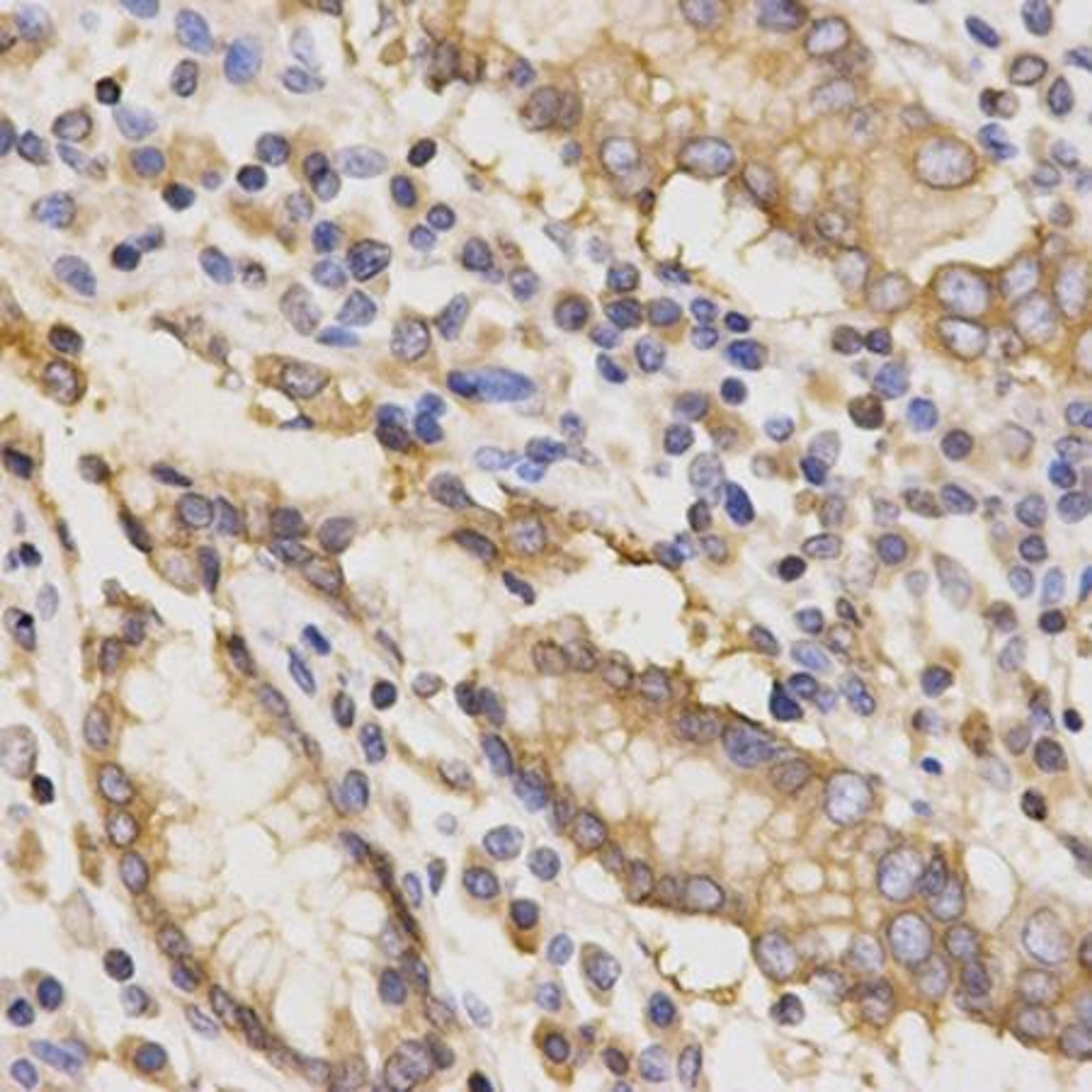 Immunohistochemical analysis of formalin-fixed and paraffin-embedded human stomach tissue using TAPBP antibody (primary antibody dilution at 1:200)