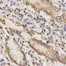Immunohistochemical analysis of formalin-fixed and paraffin-embedded human stomach tissue using TAPBP antibody (primary antibody dilution at 1:200)