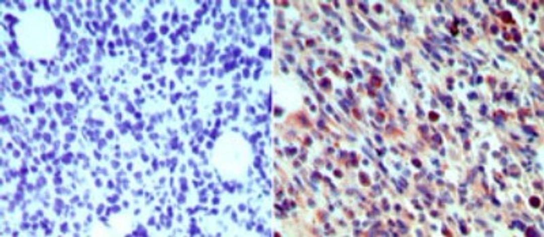 Immunohistochemistry-Paraffin: Langerin Antibody [NB100-56733] - Analysis of langerin (CD207) in paraffin-embedded formalin-fixed mouse breast tissue using an isotype control antibody (left) and langerin (CD207) antibody (right) at 5 ug/ml.