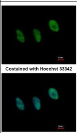 Immunocytochemistry/Immunofluorescence: NFYB Antibody [NBP2-19534] - Immunofluorescence analysis of paraformaldehyde-fixed HeLa, using antibody at 1:500 dilution.