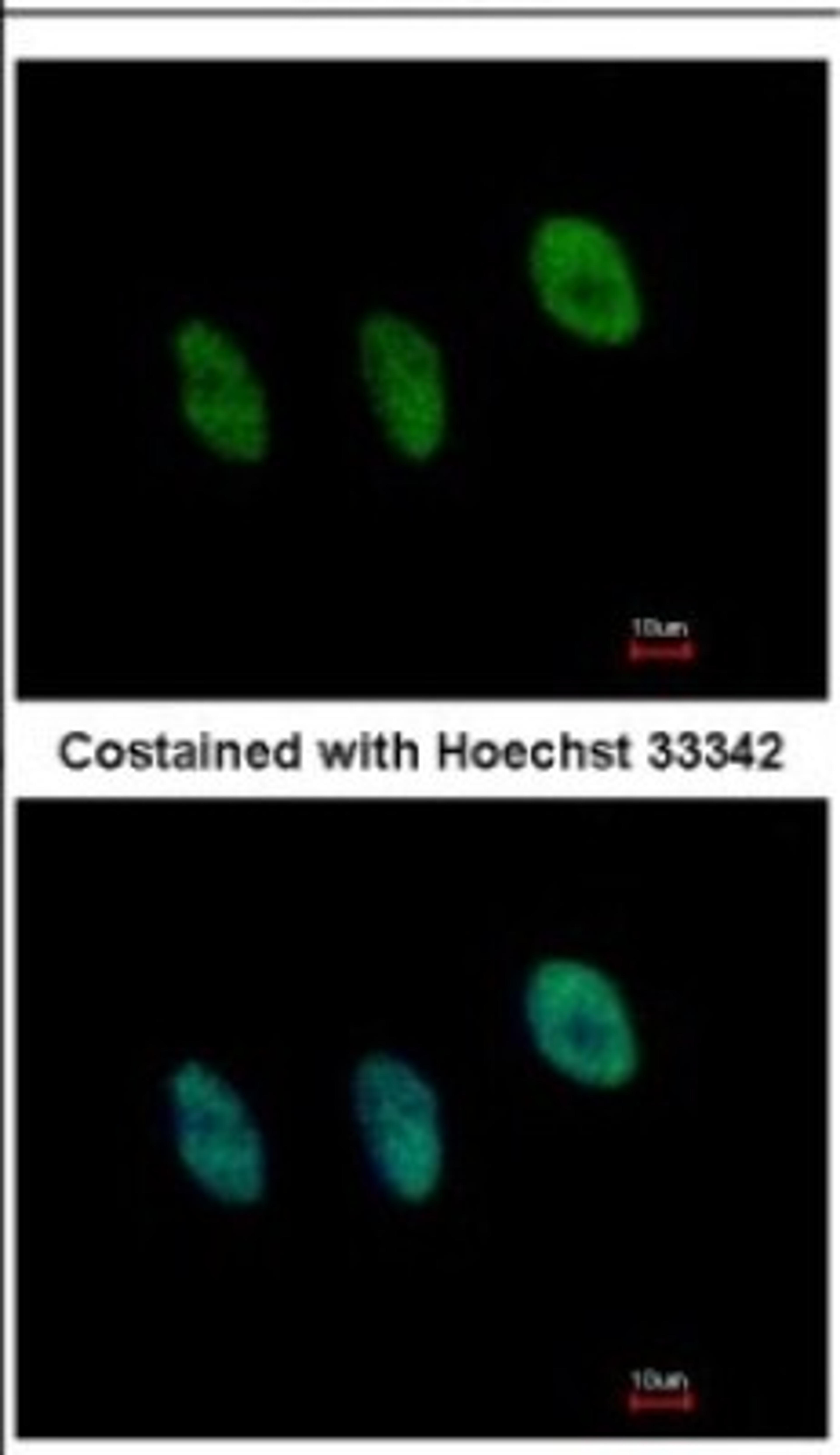 Immunocytochemistry/Immunofluorescence: NFYB Antibody [NBP2-19534] - Immunofluorescence analysis of paraformaldehyde-fixed HeLa, using antibody at 1:500 dilution.