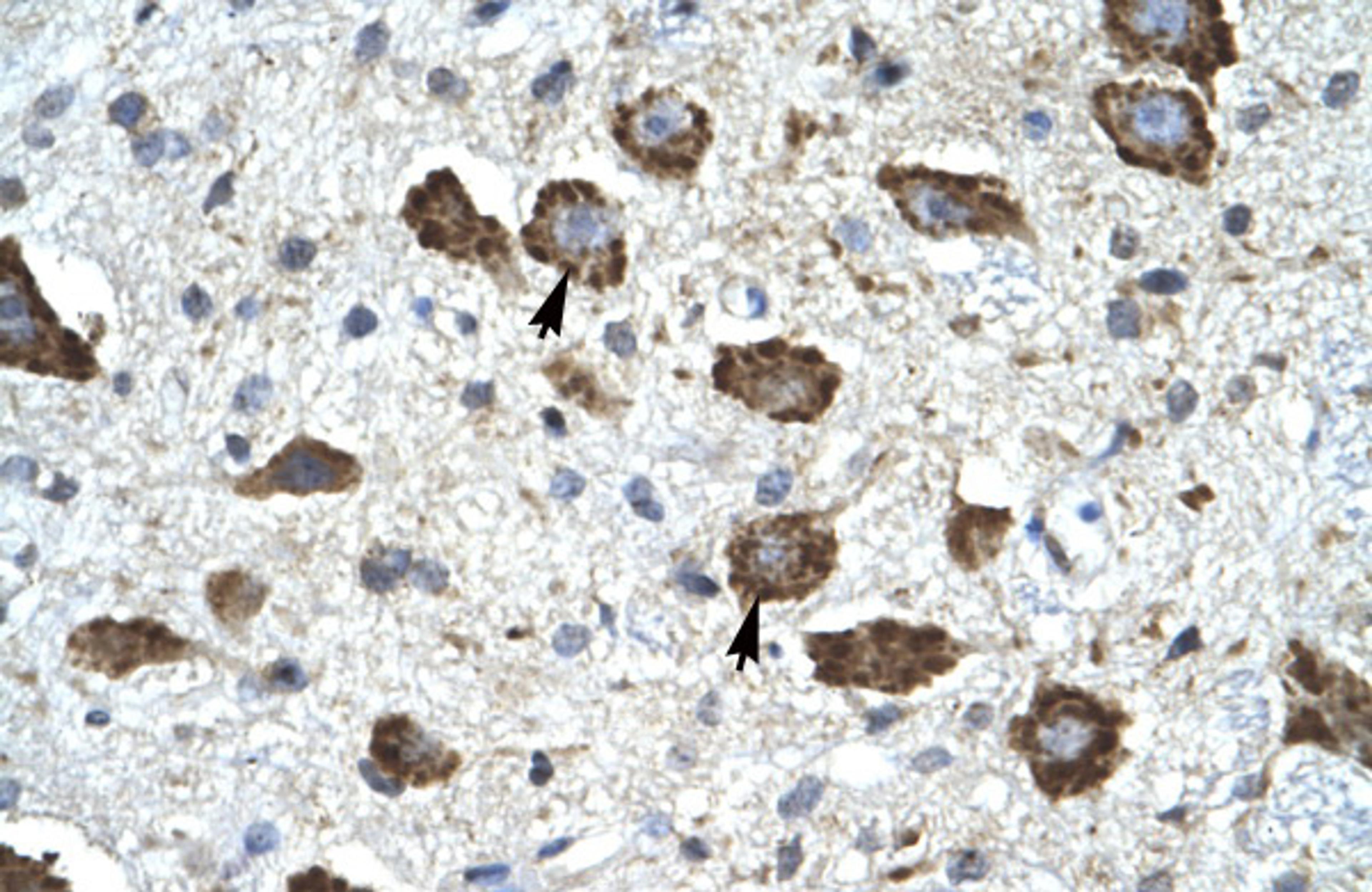 Antibody used in IHC on Human Brain.