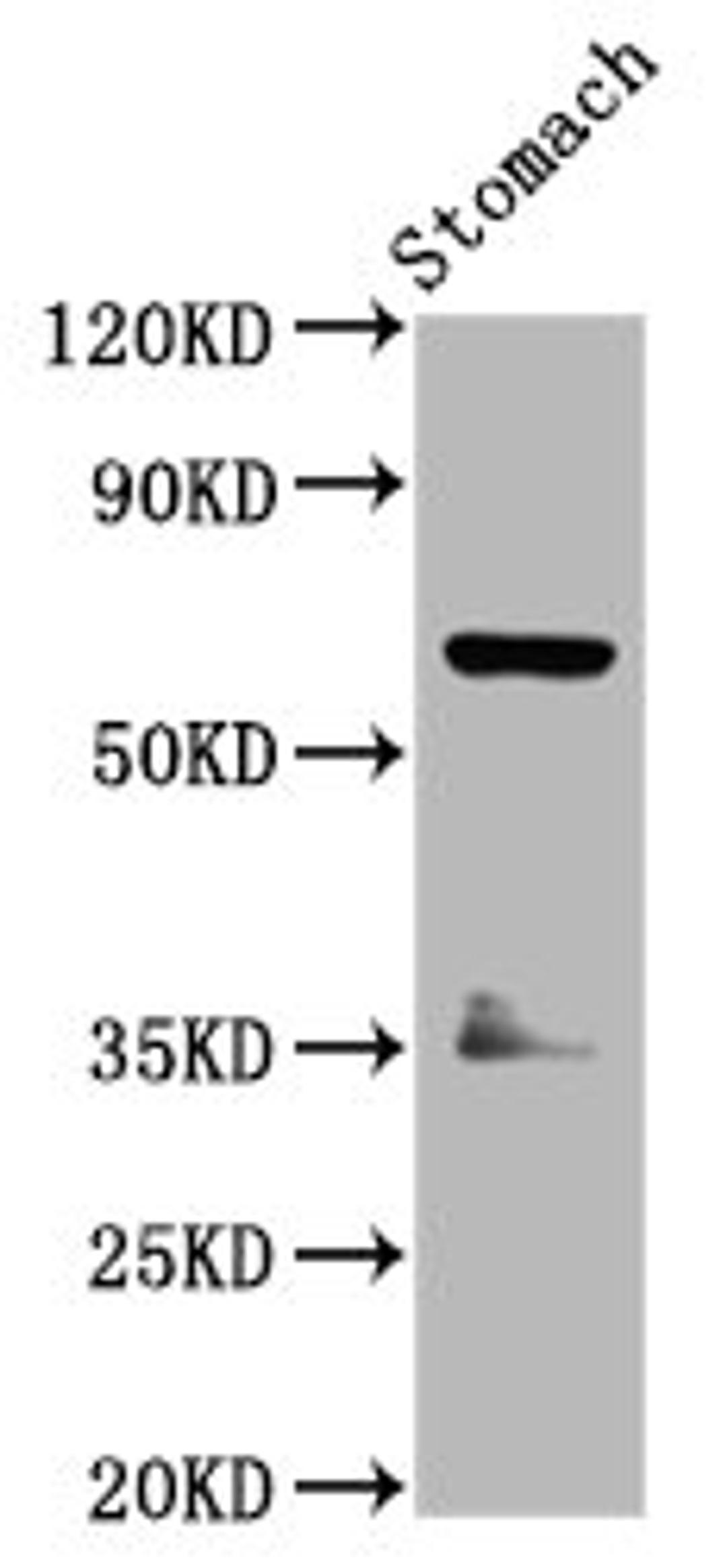 Western Blot. Positive WB detected in: Rat stomach tissue. All lanes: SLC5A5 antibody at 3.7ug/ml. Secondary. Goat polyclonal to rabbit IgG at 1/50000 dilution. Predicted band size: 69 kDa. Observed band size: 69 kDa. 