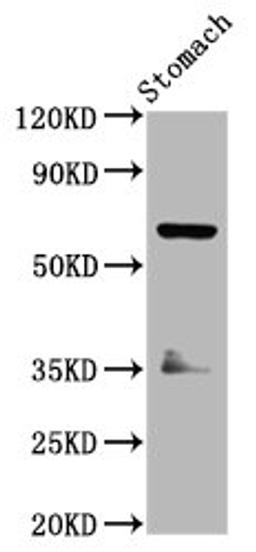 Western Blot. Positive WB detected in: Rat stomach tissue. All lanes: SLC5A5 antibody at 3.7ug/ml. Secondary. Goat polyclonal to rabbit IgG at 1/50000 dilution. Predicted band size: 69 kDa. Observed band size: 69 kDa. 