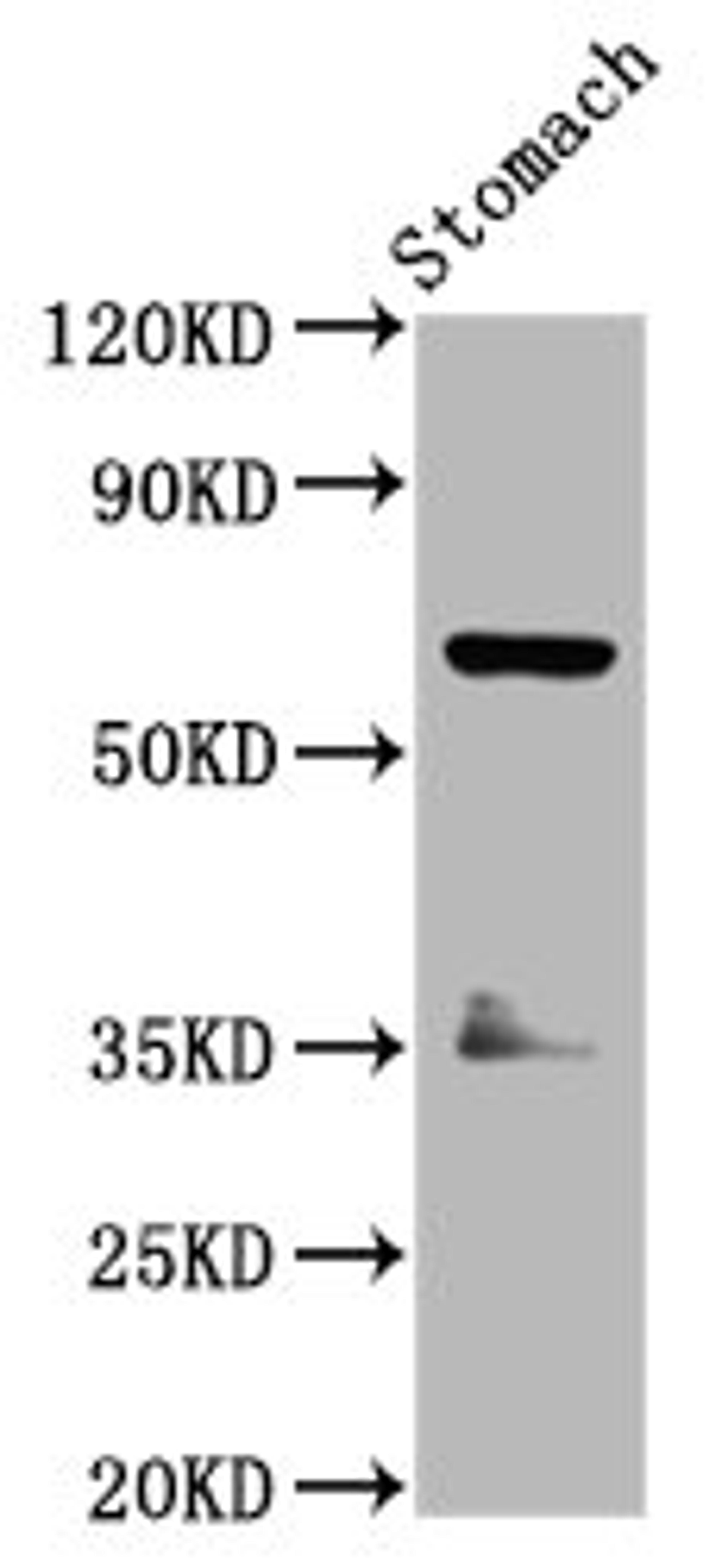 Western Blot. Positive WB detected in: Rat stomach tissue. All lanes: SLC5A5 antibody at 3.7ug/ml. Secondary. Goat polyclonal to rabbit IgG at 1/50000 dilution. Predicted band size: 69 kDa. Observed band size: 69 kDa. 