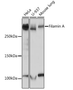 Western blot - Filamin A Rabbit mAb (A3738)
