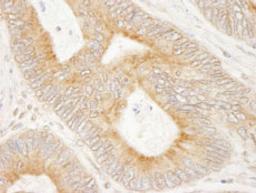 Detection of human MAP7 by immunohistochemistry.