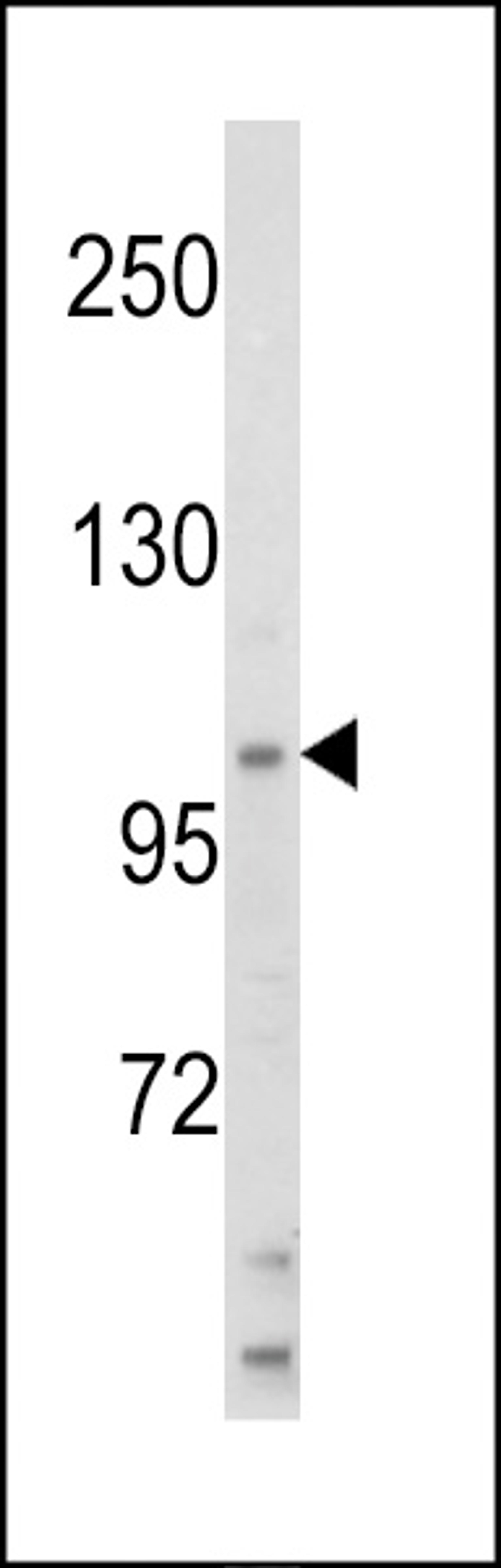 Western blot analysis of HIP116A Antibody in HL60 cell line lysates (35ug/lane)