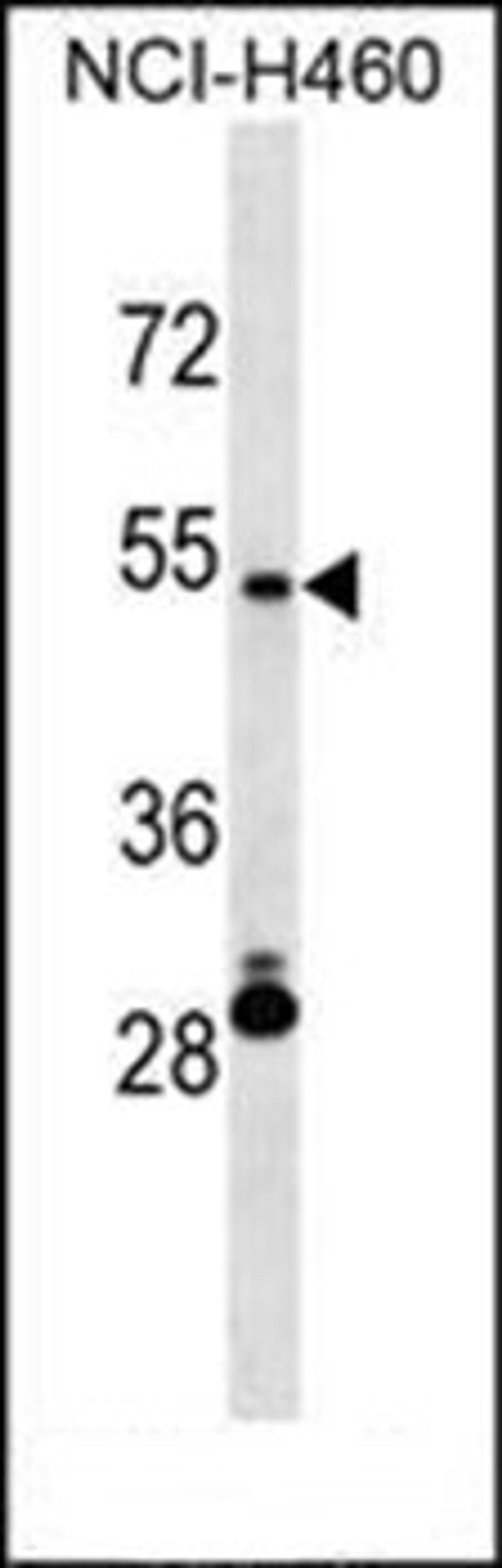 Western blot analysis of NCI-H460 cell line lysates (35ug/lane) using IRX6 antibody (Center)