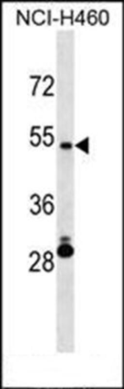 Western blot analysis of NCI-H460 cell line lysates (35ug/lane) using IRX6 antibody (Center)