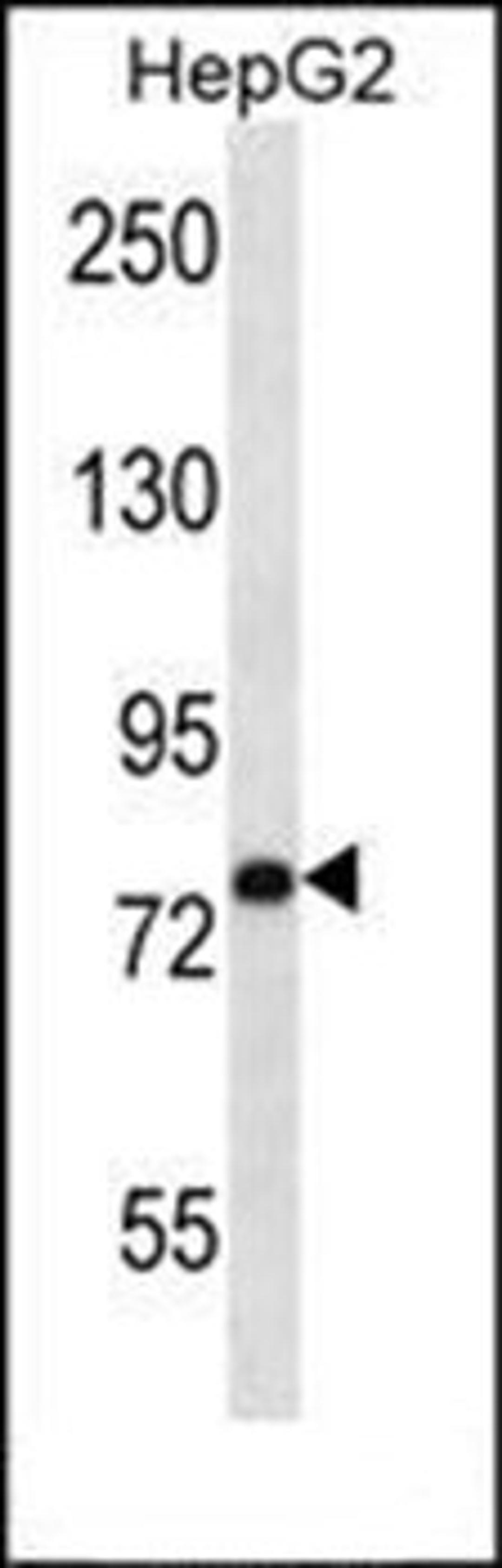 Western blot analysis of HepG2 cell line lysates (35ug/lane) using USP45 antibody (Center)