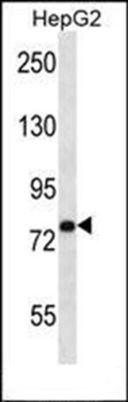 Western blot analysis of HepG2 cell line lysates (35ug/lane) using USP45 antibody (Center)