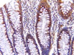 Immunohistochemistry-Paraffin: AIF Antibody [NBP2-27177] - Staining of AIF in formalin-fixed, paraffin-embedded normal human colon using this antibody at 1:2000. Hematoxylin-eosin counterstain. In this example, AIF expression is predominant in the upper part of the crypt.