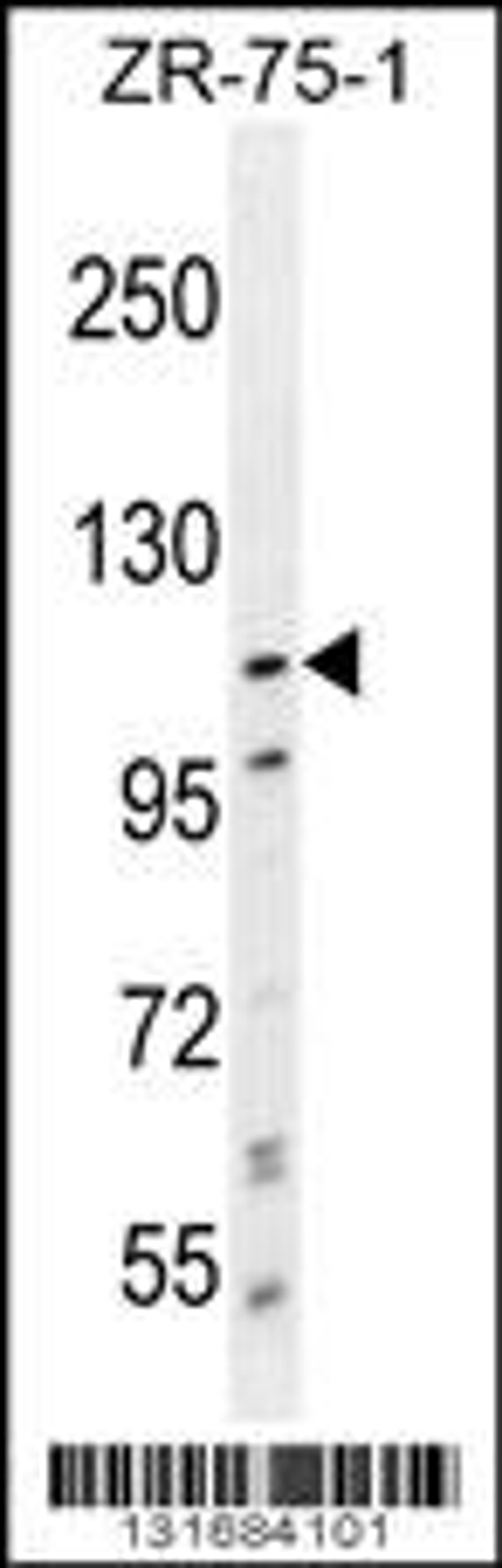 Western blot analysis in ZR-75-1 cell line lysates (35ug/lane).