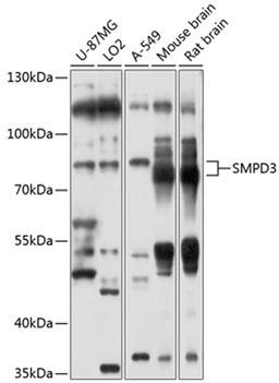 Western blot - SMPD3 antibody (A10197)